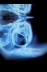 Mobile Magic X-Ray v2.0 .ipa