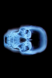 Mobile Magic X-Ray v2.0 .ipa
